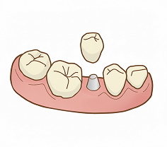 治療計画のイラストイメージ
