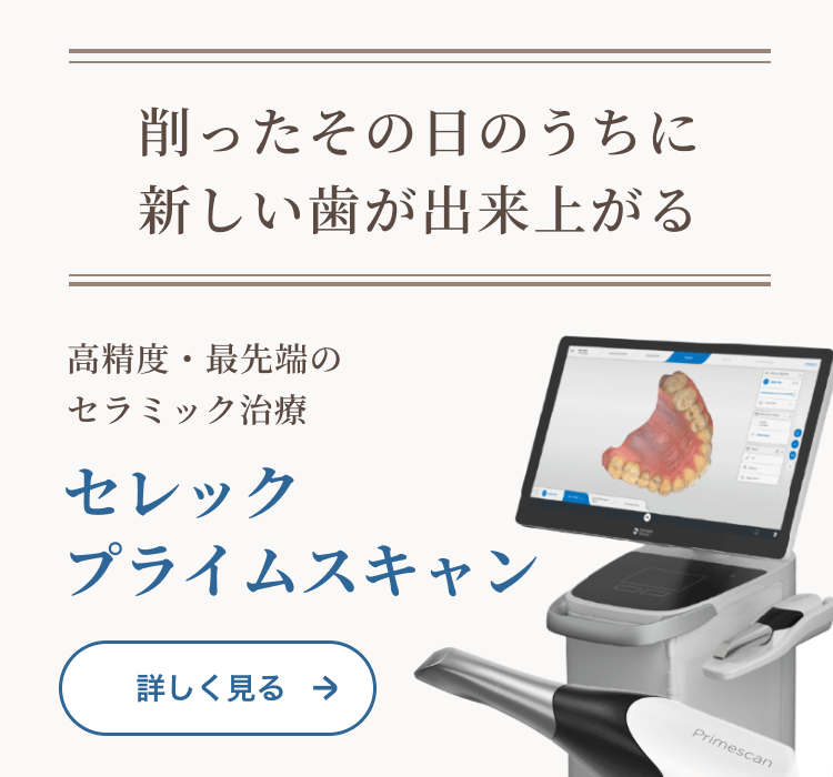 セレックプライムスキャン