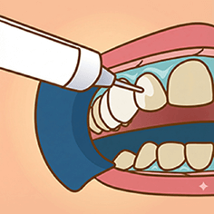 ホワイトニング施術のイラストイメージ